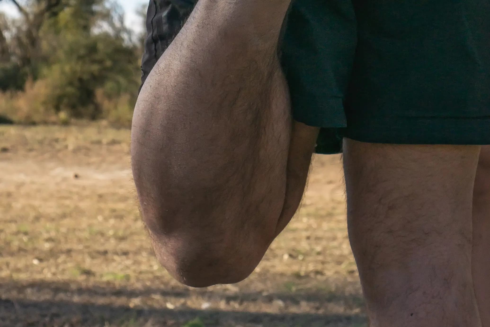 Close up of a knee